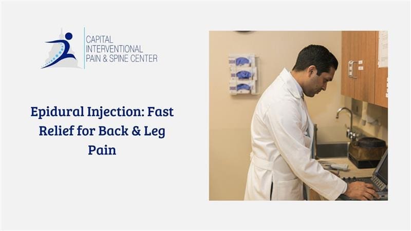 Epidural Injection Fast Relief for Back & Leg Pain